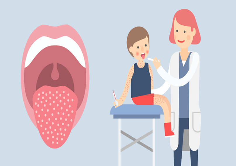 Скарлатина4