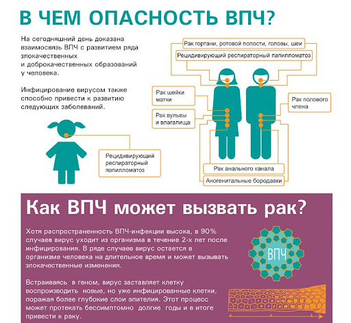 ВПЧ памятка